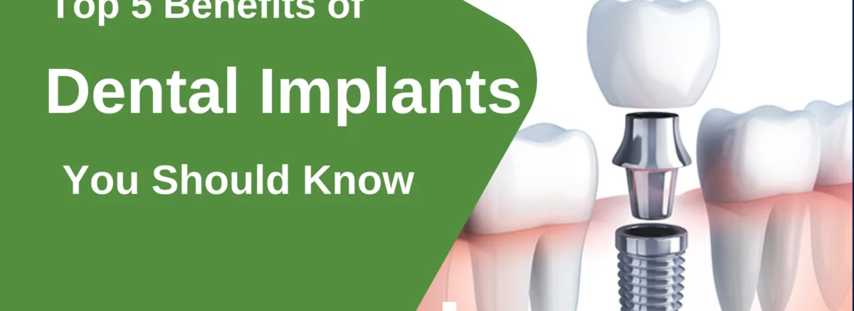 dental implants in Greater Noida