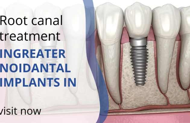 root canal treatment in Greater Noida
